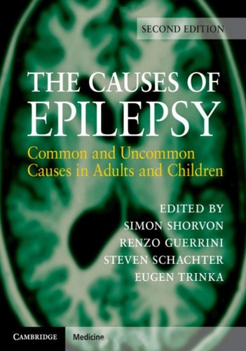 The Causes of Epilepsy Common and Uncommon Causes in Adults and Children