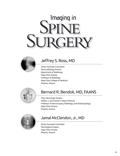 Imaging in Spine Surgery EtvITmO0_t