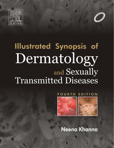 Illustrated Synopsis of Dermatology and Sexually Transmitted diseases by Neena K