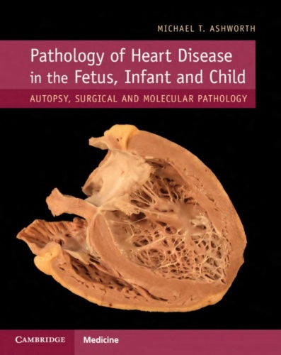 Pathology of Heart Disease in the Fetus, Infant and Child Autopsy, Surgical and