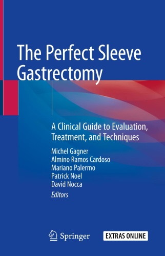 The Perfect Sleeve Gastrectomy - A Clinical Guide to Evaluation, Treatment, and