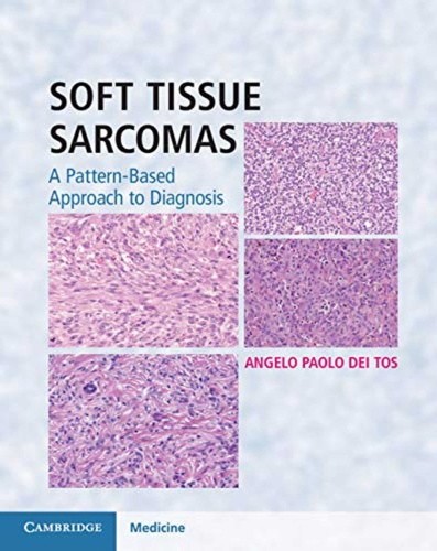 Soft Tissue Sarcomas Hardback with Online Resource A Pattern-Based Approach to D