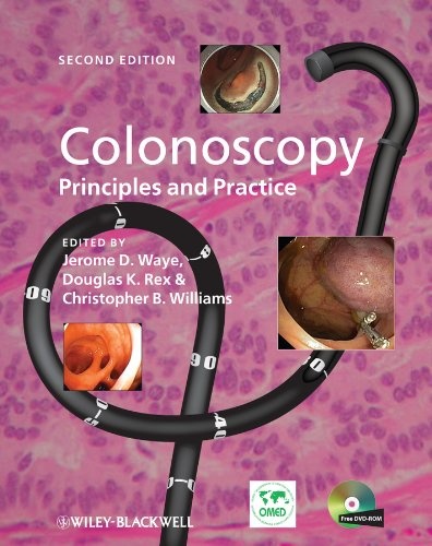 Colonoscopy   Principles and Practice Ed 2