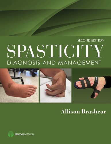Spasticity   Diagnosis and Management,
